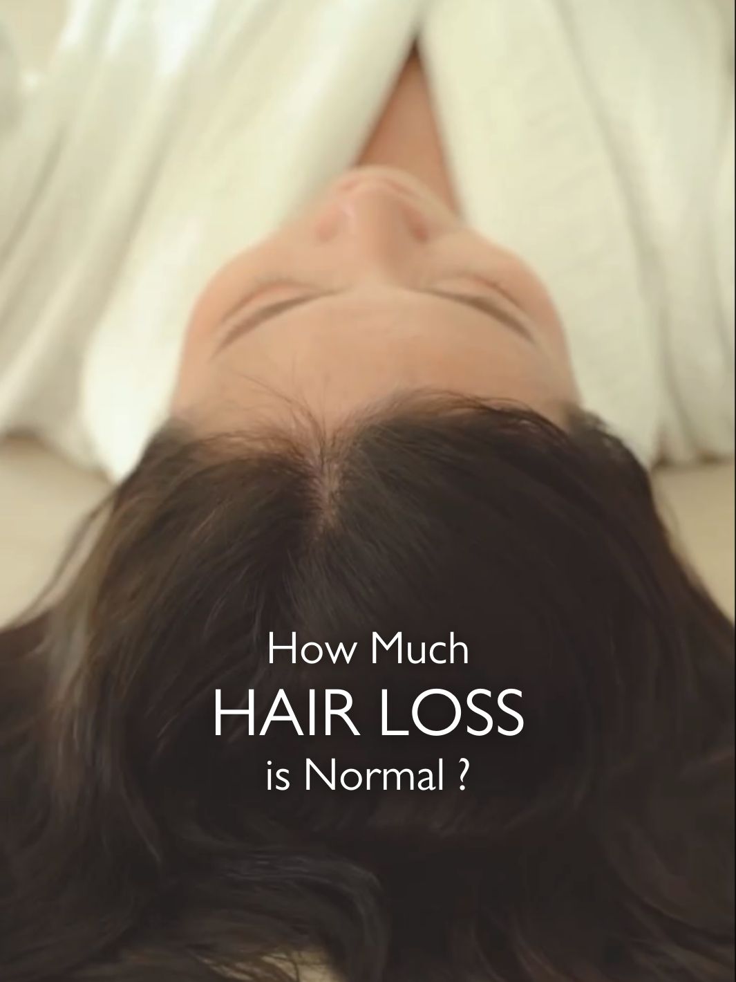 How Much Hair Loss Is Normal?